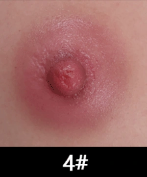 乳輪カラー 4番