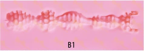 B1