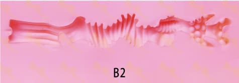 B2