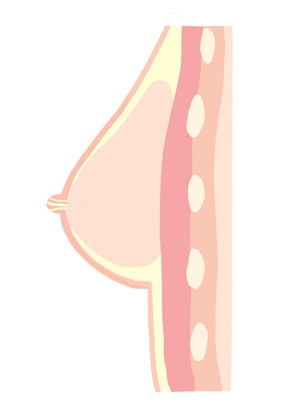 TOPSINO 149cm Fカップ T50ヘッド 乳腺構造要否 希望しない