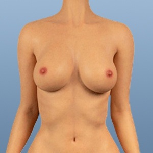 Real Lady 159cm Hカップ R1ヘッド 肌の色 #3 黄褐色